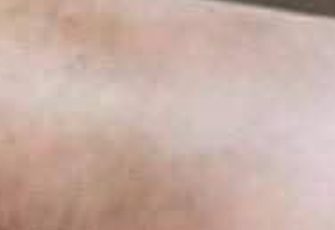 If You Suffer from Poor Circulation and Your Legs Feel Like This, Here Is the Solution: