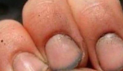 What do you call a person who has nails like that?