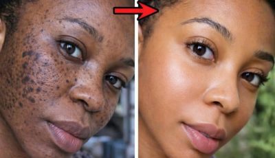 Search Results for: Can Potatoes and Ginger from Your Kitchen Support Brighter, More Even-Looking Skin?
