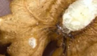 The Health Benefits of Walnuts: A Superfood for Heart, Brain, and Overall Well-being