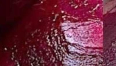 Boost your collagen with these fantastic beetroot recipes to enjoy every evening.