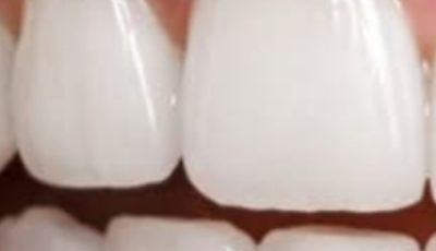 Turmeric and Baking Soda: A Gentle Natural Blend to Support a Cleaner, Brighter Smile
