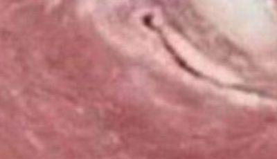 Search Results for: What do you see first
