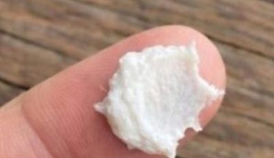 5 Simple Natural Home Remedies to Help Prevent Cavities and Support Healthy Teeth