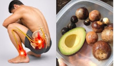 Avocado Leaf Benefits: Traditional Uses, Tea Recipes, and Important Precautions