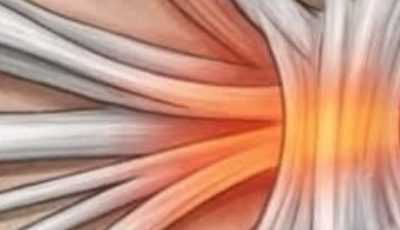 Why Do Your Hands Fall Asleep Frequently? Your Body Could Be Warning You
