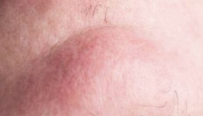 Surprising Truth About Chin Whiskers in Women