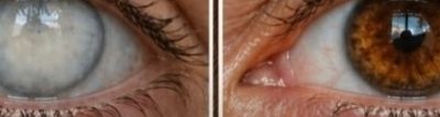 Can a nighttime habit support eye health after age 60?